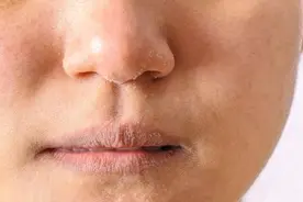坚持敷面膜补水，为啥肌肤还是干干的？你可能忽略保湿了图片