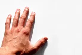 手上青筋凸起，是毒素堆积吗？身体3个地方有青筋，要留意3种病图片