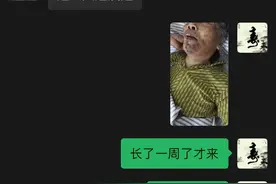 古派巨灵针灸治疗带状疱疹破溃并感染发热实例分享图片