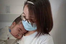 两岁儿子变“毛孩”，我自责不已图片