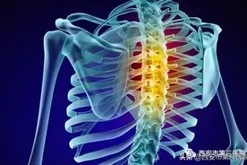 【为你解惑】不再让背痛困扰你图片