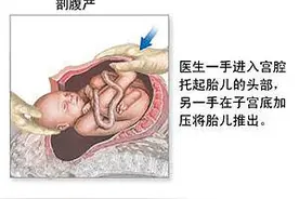 孩子是妈妈用命换来的|生孩子的那种痛|刻骨铭心同时也让人成长图片