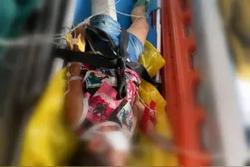 紧急！孩子玩耍不慎从四楼摔下！一路疾驰！只为那幼小的生命图片