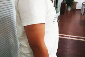 夏季是减肥绝佳期，为啥有人体重不降反升？问题究竟出在哪？图片