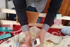 黄疸家里测，靠谱不？图片