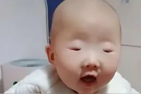 “绿豆眼”宝宝走红！眼睛大小约等于零，网友：睁到最大了吗？图片