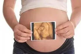 做四维彩超前，孕妈要牢记这4个“要点”，否则就会受累一整天图片