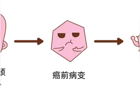 女友想打HPV疫苗，却让我检查HPV！我该怎么办图片