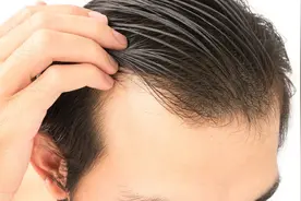 头发变得稀少，与内脏状况关系大吗？中医解答，教你拥有浓密头发图片
