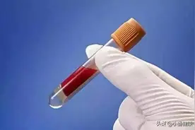 乙肝感染没有那么容易，身体既要有伤口，又要碰到感染者伤口处图片