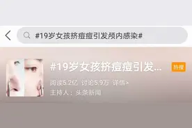19岁女孩挤痘痘竟引发颅内感染！应该如何安全科学祛痘？图片