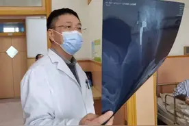 祝贺！北京积水潭医院周一新教授团队荣获北京市科学技术进步奖一等奖图片