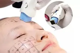 准备做热玛吉，医生说这5点先了解清楚图片