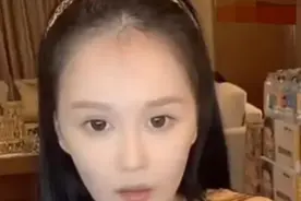 赵本山24岁女儿脱发严重，无美颜照曝光引热议，被嘲像“地中海”图片