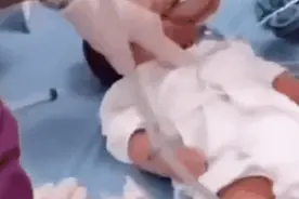 出生仅7天，新生儿疑因呛奶窒息！十几名医护持续抢救1小时，奇迹发生图片