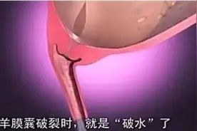 顺产时胎儿是怎么从产道娩出的？组图给你答案，看完觉得下体一凉图片