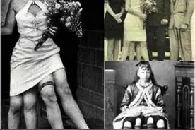 女孩天生4条腿，13岁成名，19岁结婚，21岁生下孩子，60岁去世图片