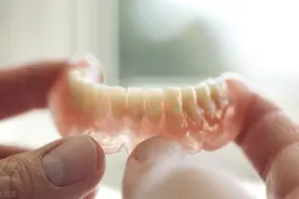 活动假牙真的能省钱吗？图片