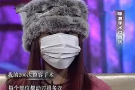 网红16岁开始整容，200多次手术花费400万，后遗症致其只能坐轮椅图片