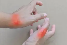 医生提醒：夜里睡觉反复出现5种症状，警惕高尿酸找麻烦图片