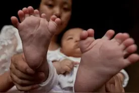 宝宝多了六根脚趾和5根手指，妈妈看到后，扇了自己一巴掌图片