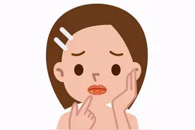 血小板减少嘴有“血疱”怎么办？图片