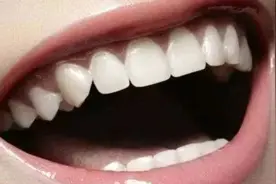 红糖加它来刷牙，牙垢哗哗往下掉，在家就能自己洗，既省钱又实用图片