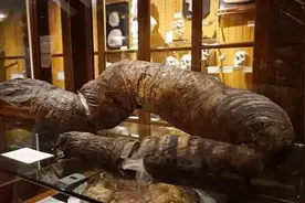 29岁外国小伙被屎憋死，中医叹息：若能辨证虚实，不至于此图片