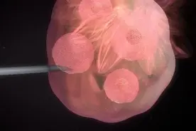 试管婴儿手术中降调是什么意思？怎样降调才算成功？图片