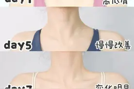 5步get少女背、直角肩｜改善斜方肌教程❗️养出天鹅颈❗️图片