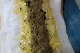 督脉灸，非常靠谱的补阳方法，24节气转换时都可以试试图片
