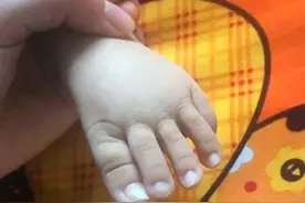 孩子天生“长脚趾”被嘲笑？妈妈这样帮助孩子图片