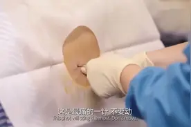 无痛针到底怎么打？组图揭秘全过程：每看一次都会觉得腰酸一次图片