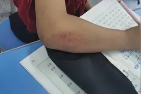 学生体育课上摔倒了，身为班主任的我一听心头一紧，连忙往操场跑图片