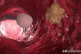 越来越多孩子得白血病，家长注意：孩子有5大异常，需及时排查图片