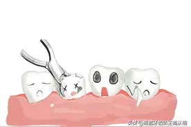不拔牙也能做矫正？图片