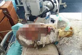 惨！女子洗澡热水器突然爆炸，全身烧伤惨不忍睹视频封面