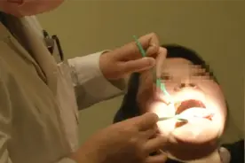 口腔白斑病是癌前病变 如何知道它在什么时候癌变呢？视频封面