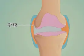 为什么有的中老年人会出现关节僵硬的情况 可能是这些原因导致视频封面