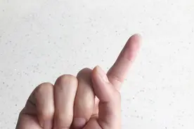手上扎刺，用针挑半天都挑不出，小伙教你一招，刺儿自己蹦出来了视频封面