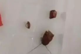 健康媛｜武汉17岁少女半夜听到异响声，旁人却听不到……图片