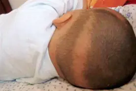 宝宝头发少，枕秃怎么办？及时这样做！再不补救就晚了！视频封面