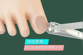 3D演示：怎样剪脚趾甲，才不会长肉里？