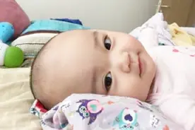 孕妈吃太多核桃，宝宝出生后，全家人惊呆了视频封面