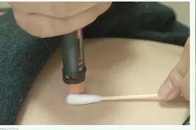 餐后2小时血糖正常值是多少？医生说不能高于这个标准视频封面