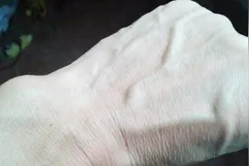 手上青筋暴起是老的？好多人都被蒙在鼓里，那是疾病发出的警报！视频封面