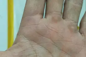 想去除双手的老茧死皮？美女姐姐教我一招，3分钟去除老茧死皮视频封面