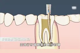 吃东西牙齿痛怎么办？美女牙医告诉你！视频封面