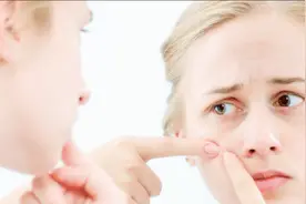 鼻子上挤出来的“白点”是怎么来的？几个小方法去除“白点”！视频封面