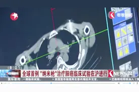 医学大事件！全球首例“纳米枪” 治肺癌 在上海缜密进行！视频封面